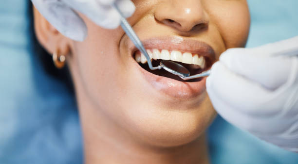 Best Urgent Dental Care for Toothaches in Petaluma, CA