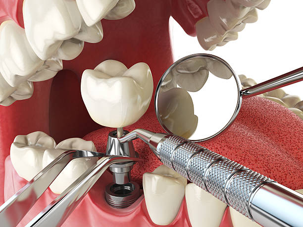Best Emergency Treatment for Jaw Pain or Injury in Petaluma, CA